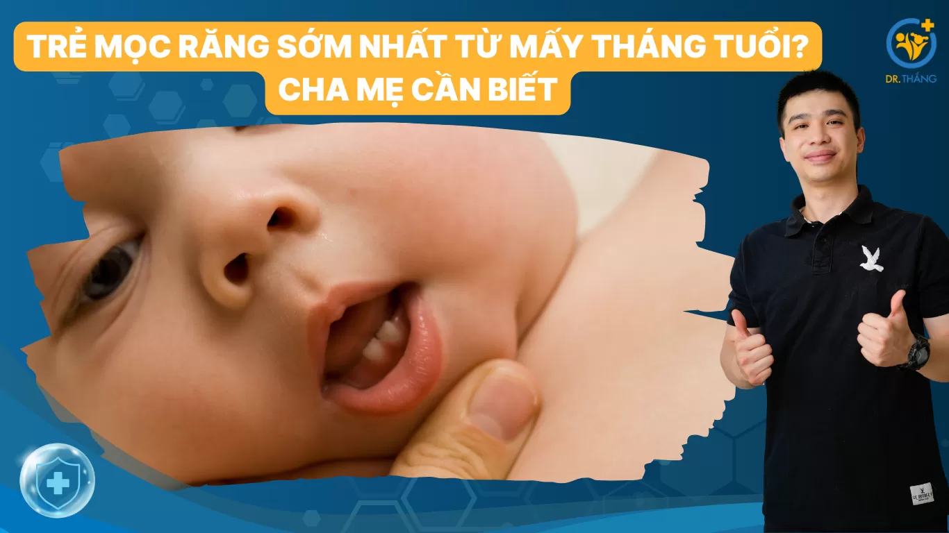 Trẻ mọc răng sớm nhất từ mấy tháng tuổi? Cha mẹ cần biết