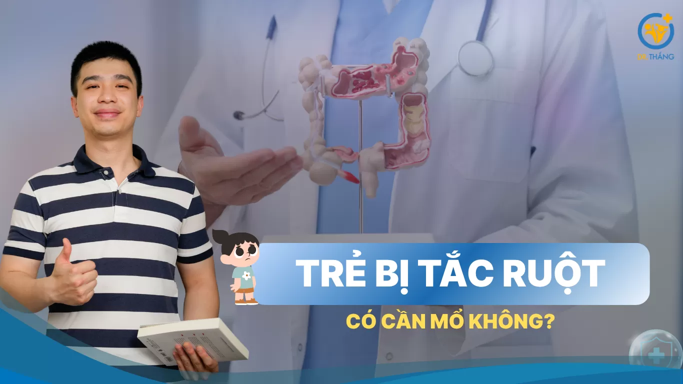 Trẻ bị tắc ruột có cần mổ không?