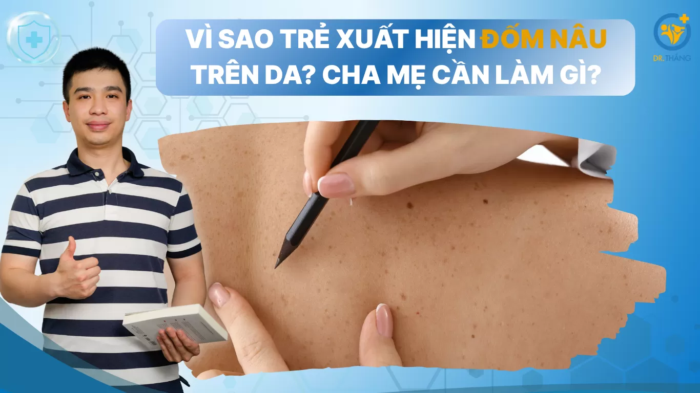 Vì sao trẻ xuất hiện đốm nâu trên da? Cha mẹ cần làm gì?