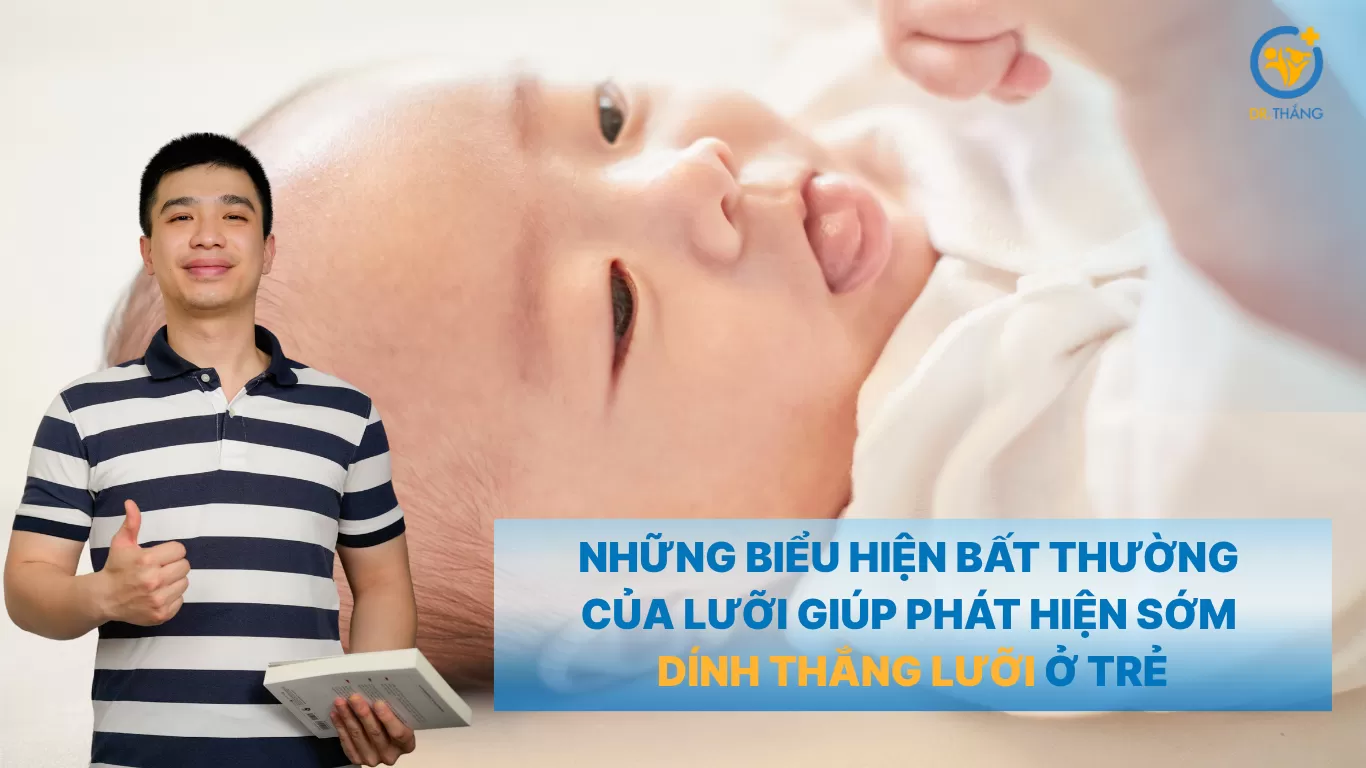 Những biểu hiện bất thường của lưỡi giúp phát hiện sớm dính thắng lưỡi ở trẻ