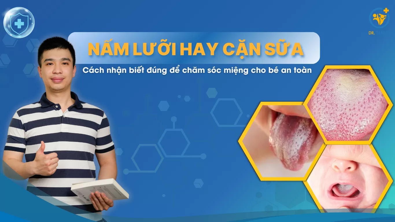 Nấm lưỡi hay cặn sữa? Cách nhận biết đúng để chăm sóc miệng cho bé an toàn