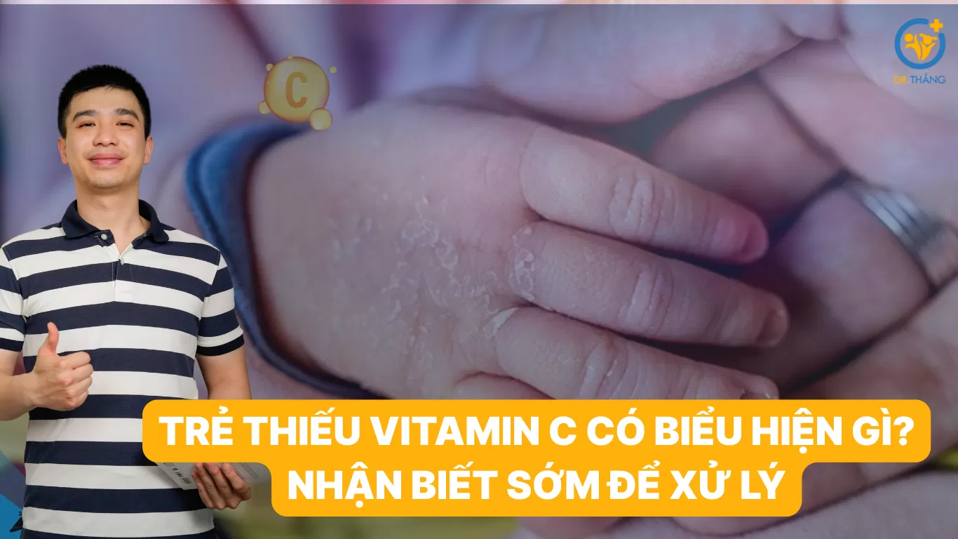 Trẻ thiếu vitamin C có biểu hiện gì? Nhận biết sớm để xử lý