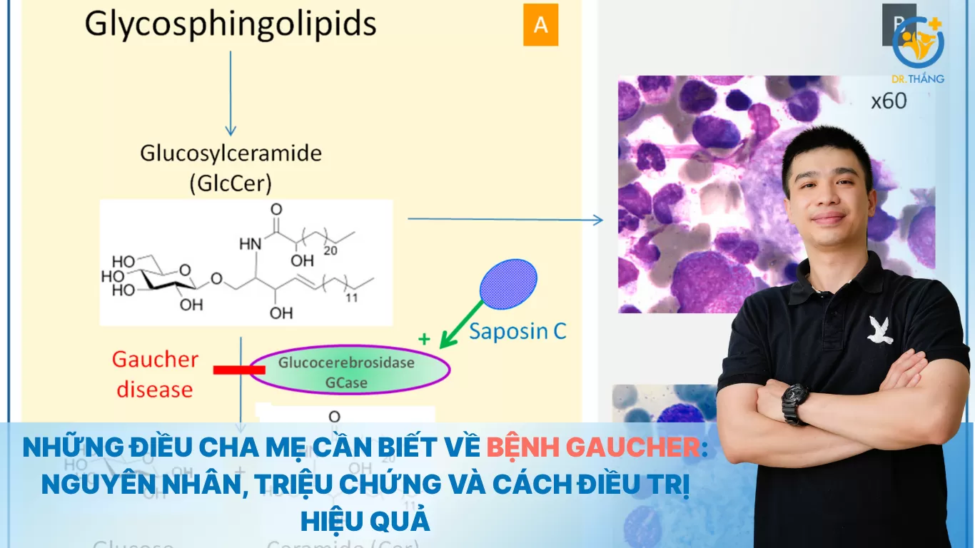 Những điều cha mẹ cần biết về bệnh Gaucher: Nguyên nhân, triệu chứng và cách điều trị hiệu quả