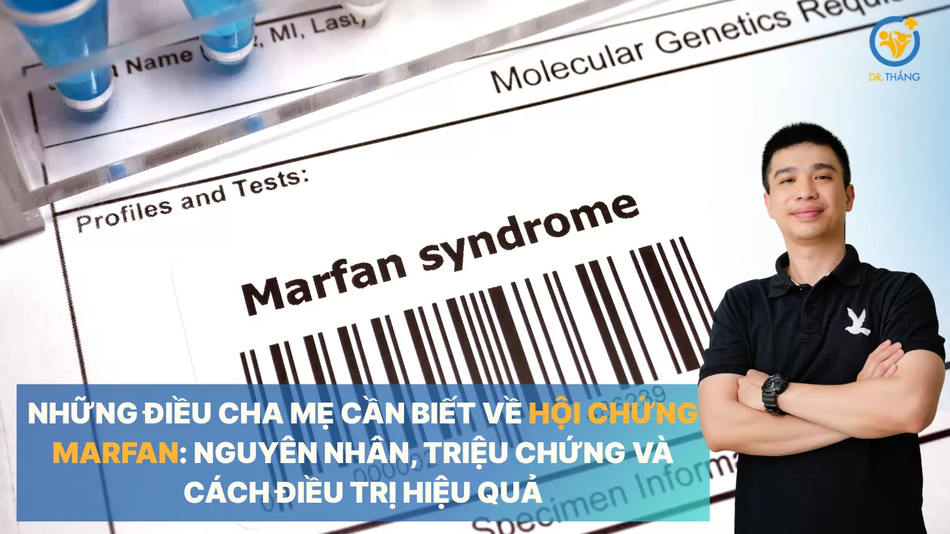 Những điều cha mẹ cần biết về hội chứng Marfan: Nguyên nhân, triệu chứng và cách điều trị hiệu quả