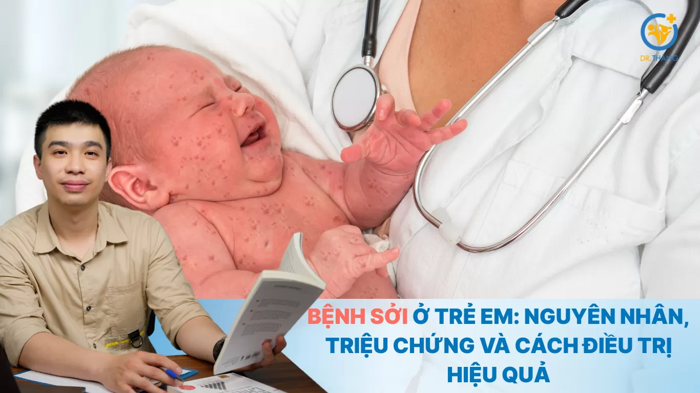 Bệnh sởi ở trẻ em: Nguyên nhân, triệu chứng và cách điều trị hiệu quả