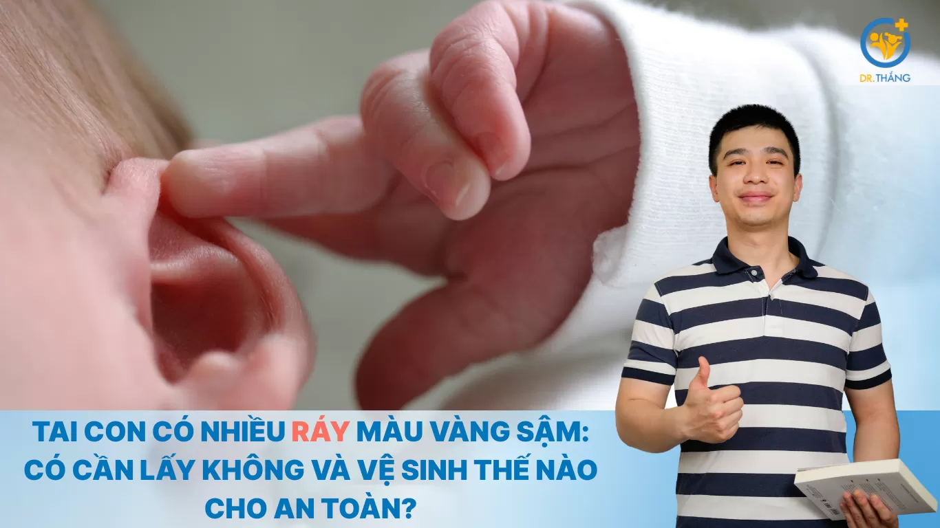 Tai con có nhiều ráy màu vàng sậm: Có cần lấy không và vệ sinh thế nào cho an toàn?