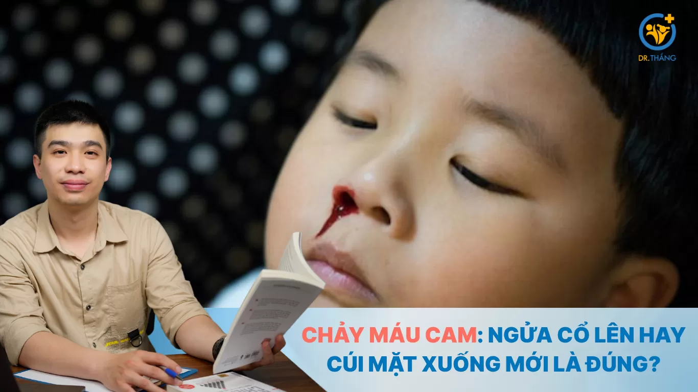 Chảy máu cam: Ngửa cổ lên hay cúi mặt xuống mới là đúng?