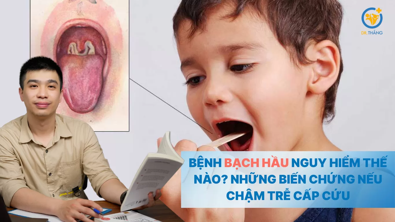 Bệnh bạch hầu nguy hiểm thế nào? Những biến chứng lên tim và thần kinh nếu chậm trễ cấp cứu