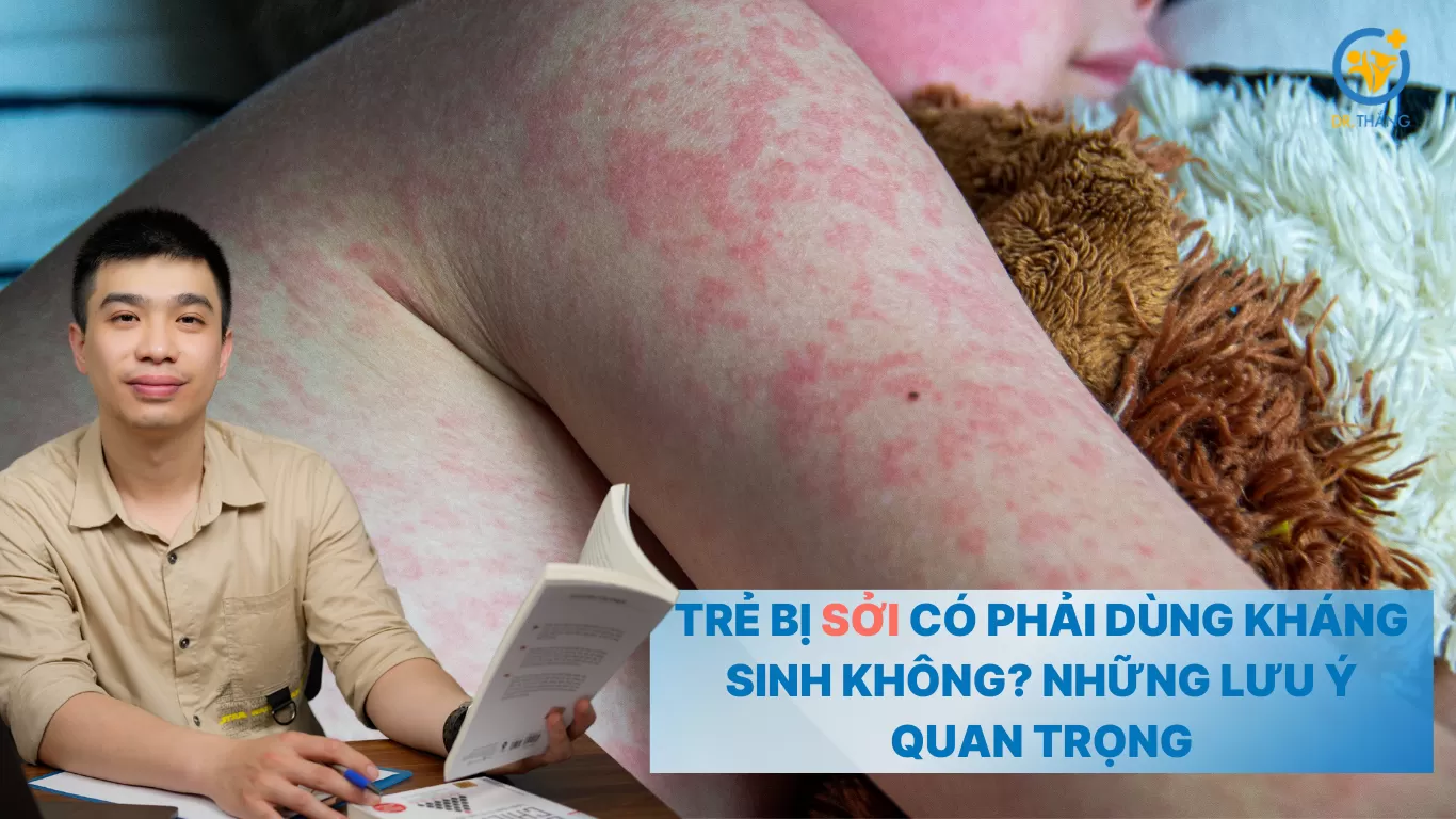 Trẻ bị sởi có phải dùng kháng sinh không? Những lưu ý quan trọng