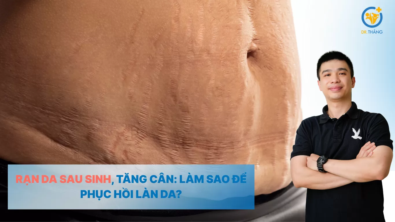 Rạn da sau sinh, tăng cân: Làm sao để phục hồi làn da?
