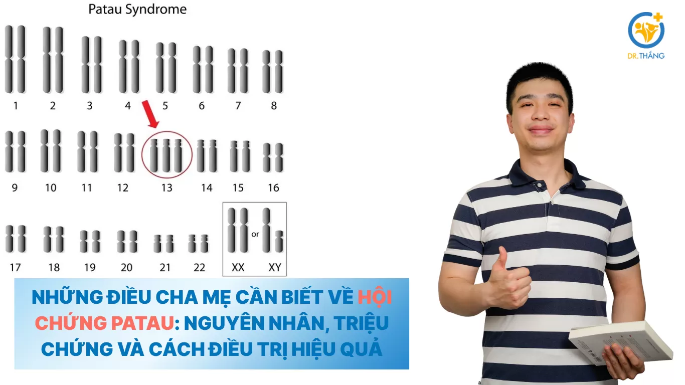 Những điều cha mẹ cần biết về hội chứng Patau: Nguyên nhân, triệu chứng và cách điều trị hiệu quả